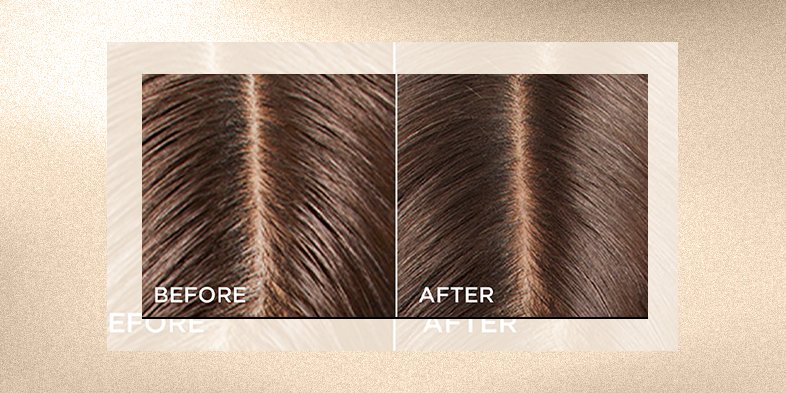 BMAGInArticleImagerypreshampootreatmentElviveHyaluron  Pure Oil Erasing Serum For Oily Hair